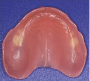 Starting denture base with no teeth
