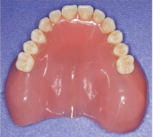 Completed denture